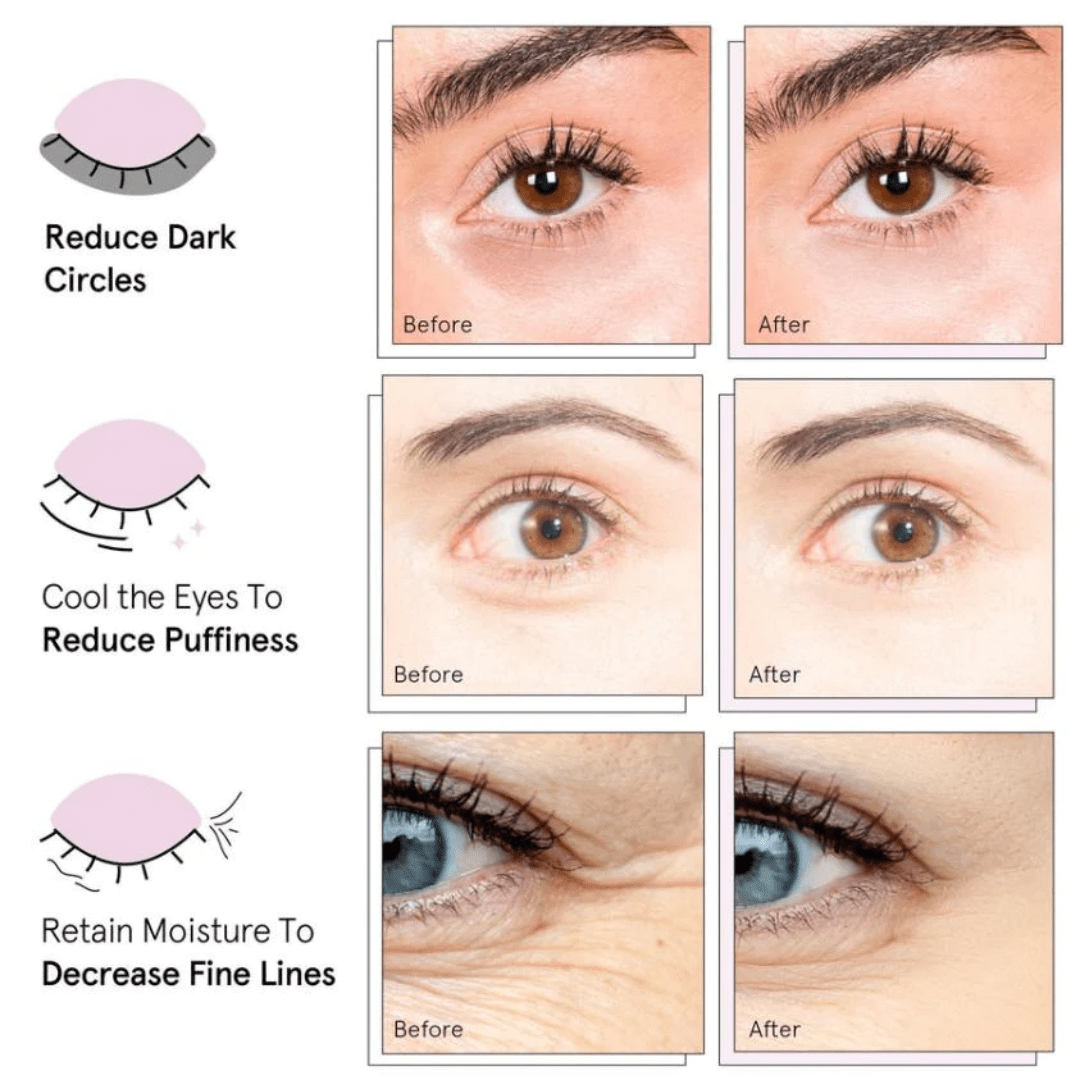 BIO-COLLAGEN EYE PATCHES