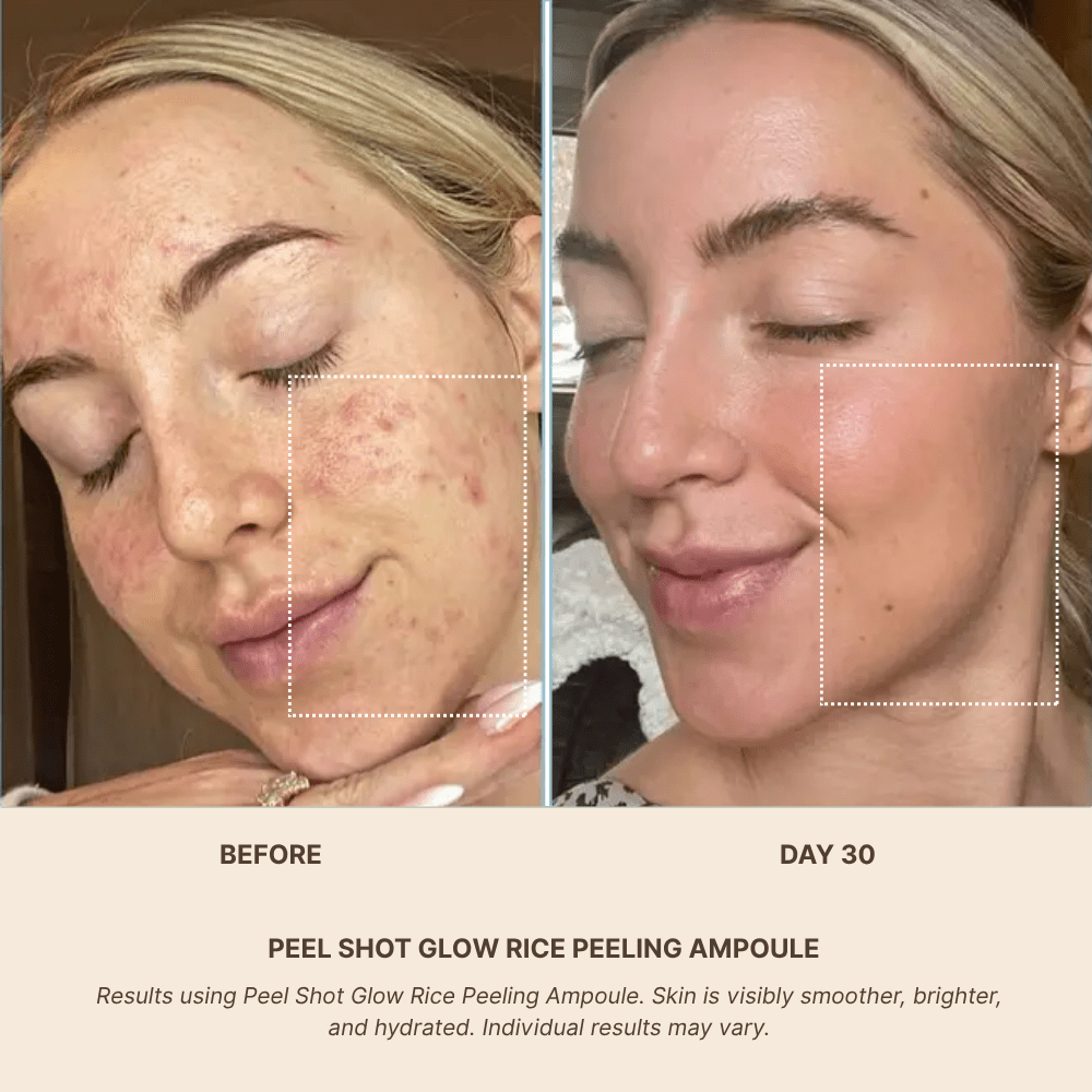 PEEL SHOT GLOW RICE AMPOULE DUO