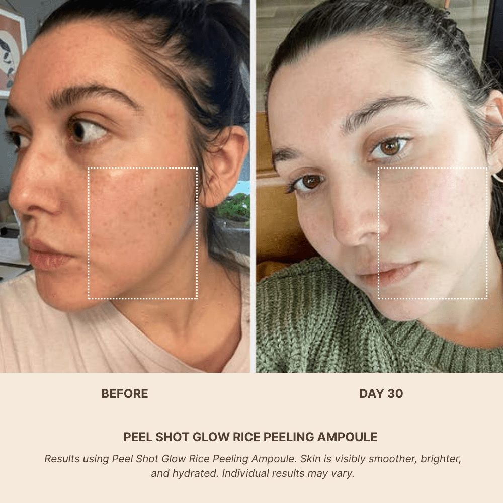 PEEL SHOT GLOW RICE AMPOULE DUO