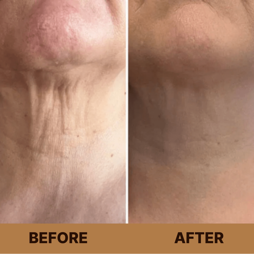 TIGHTEN & LIFT NECK CREAM