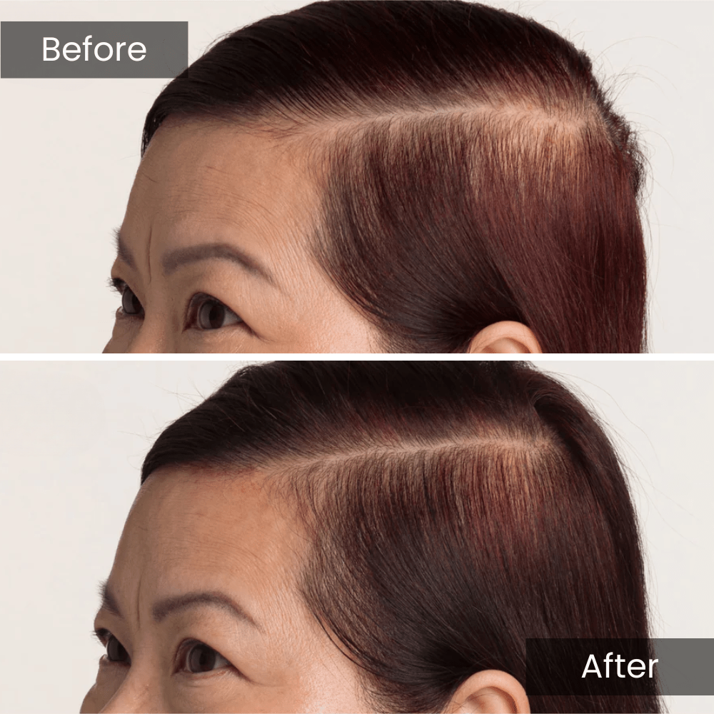 Scalpy Hair Growth Serum