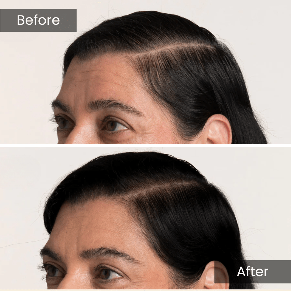 Scalpy Hair Growth Serum