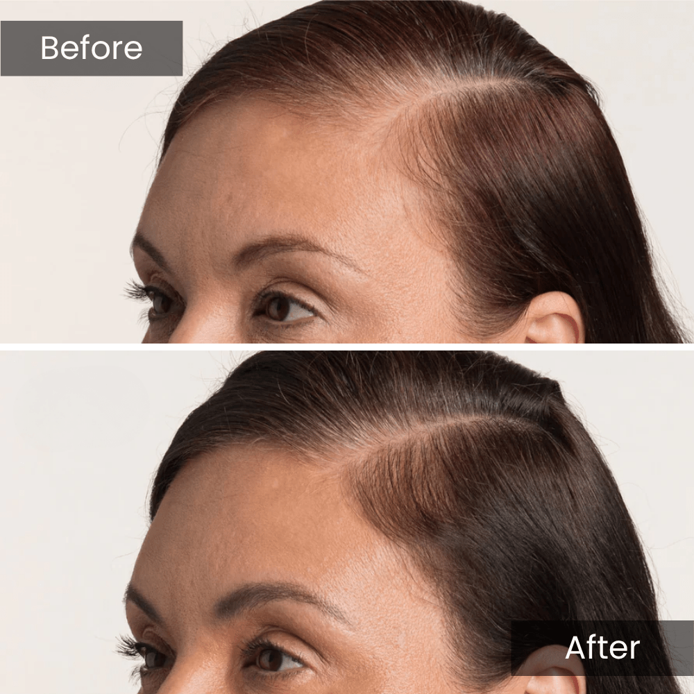 Scalpy Hair Growth Serum