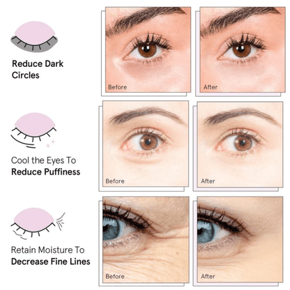 BIO-COLLAGEN EYE PATCHES
